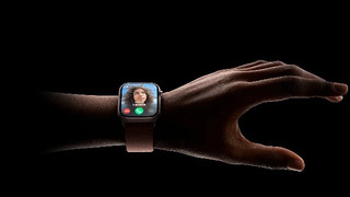 Пользователь заявил, что Apple Watch оставили ожог на руке — и уже полгода пытается добиться ответа от Apple