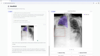 Исследователи выпустили MedRAX — медицинского ИИ-агента для анализа рентгенограмм грудной клетки