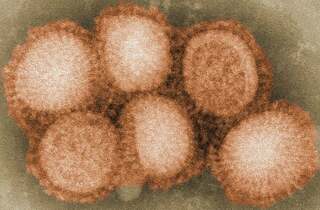 Свиной грипп шагает по планете: что известно о новом штамме и как его лечить?