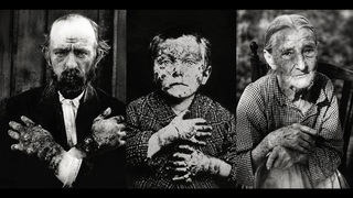 Врач ел выделения больных, чтобы доказать, что страшная болезнь не заразна