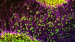 Новый метод обращения вспять клеточного старения протестируют на людях