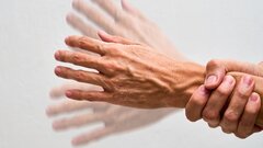 В России создали молекулу для лечения болезни Паркинсона